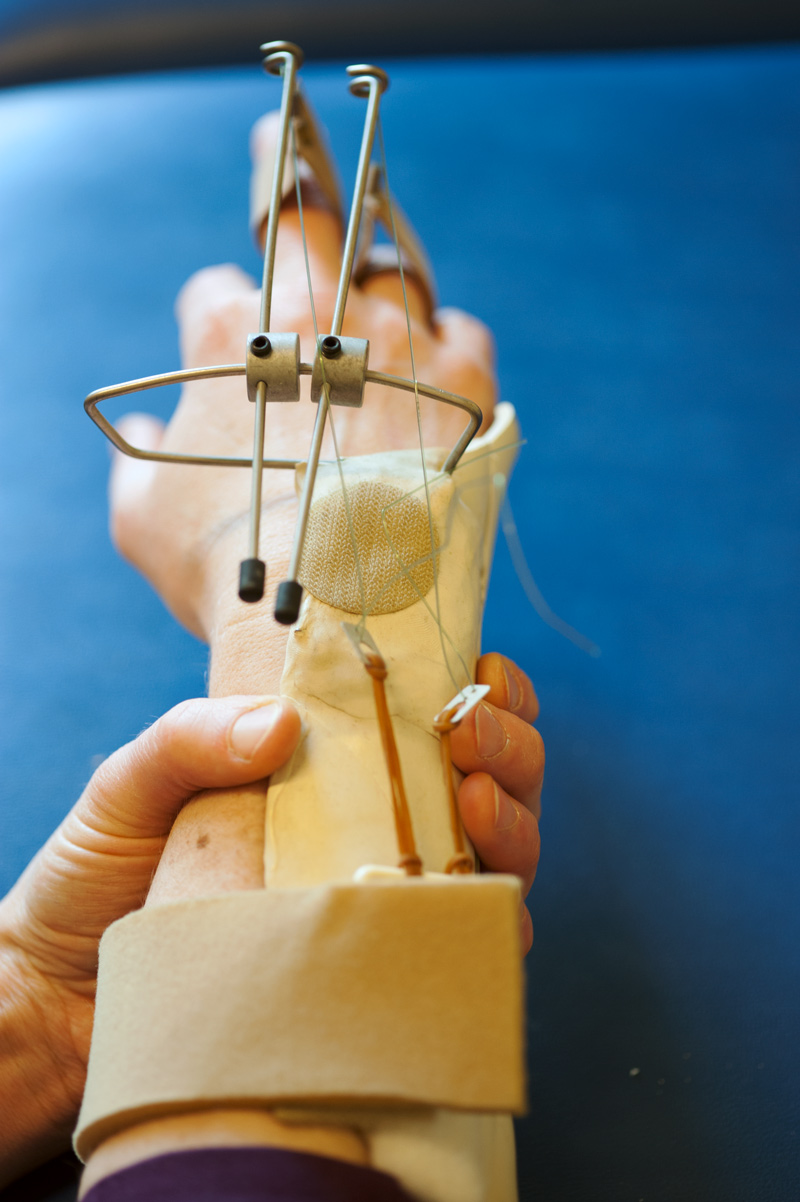 Ergotherapie Orthopädie Handtraining mit einer Schiene